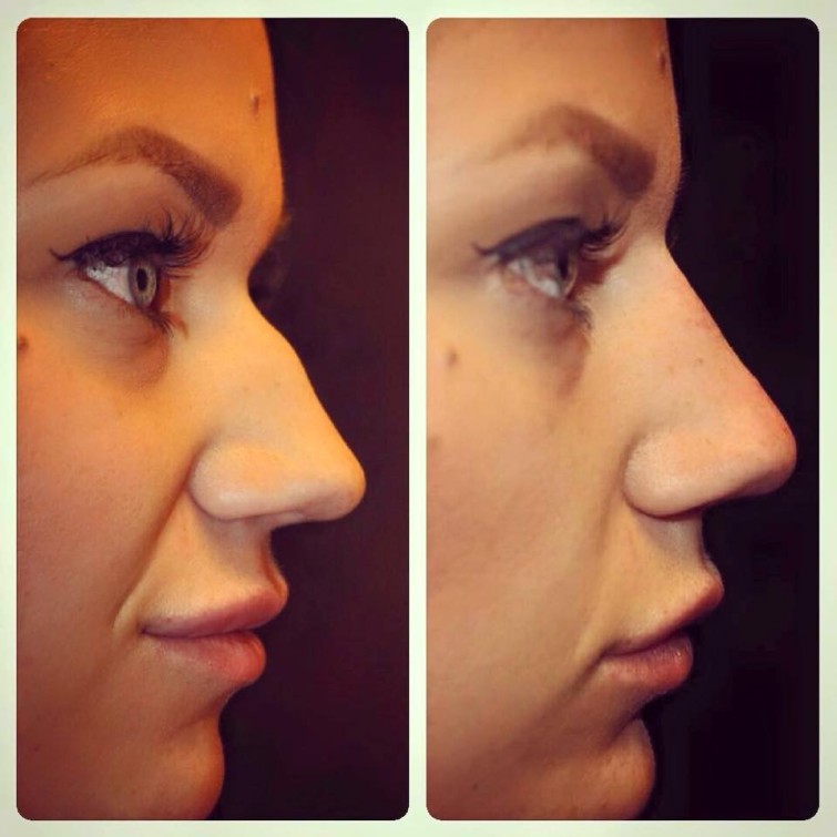 10983317_10152706998289147_6744981231468145812_n