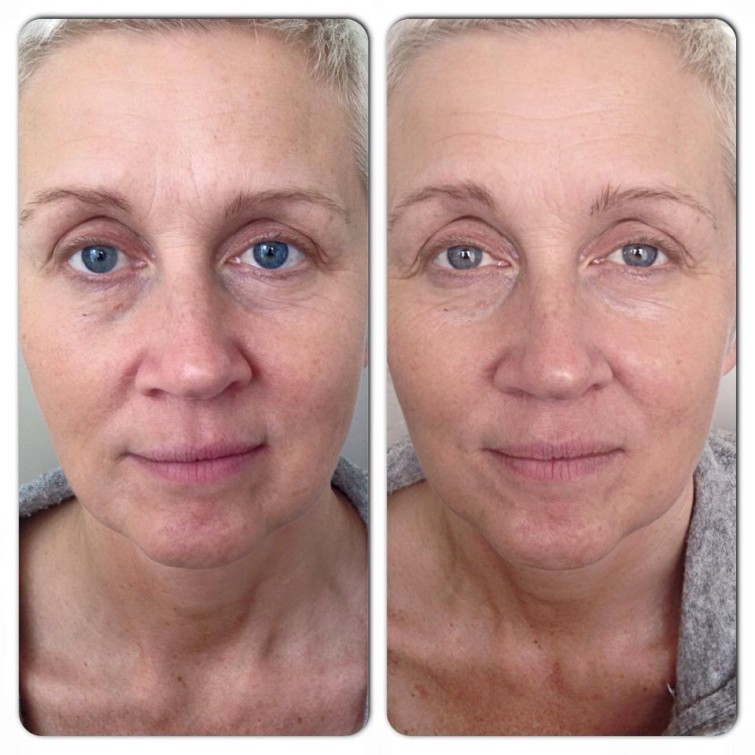 11008643_10152999734293401_499453878956722211_n