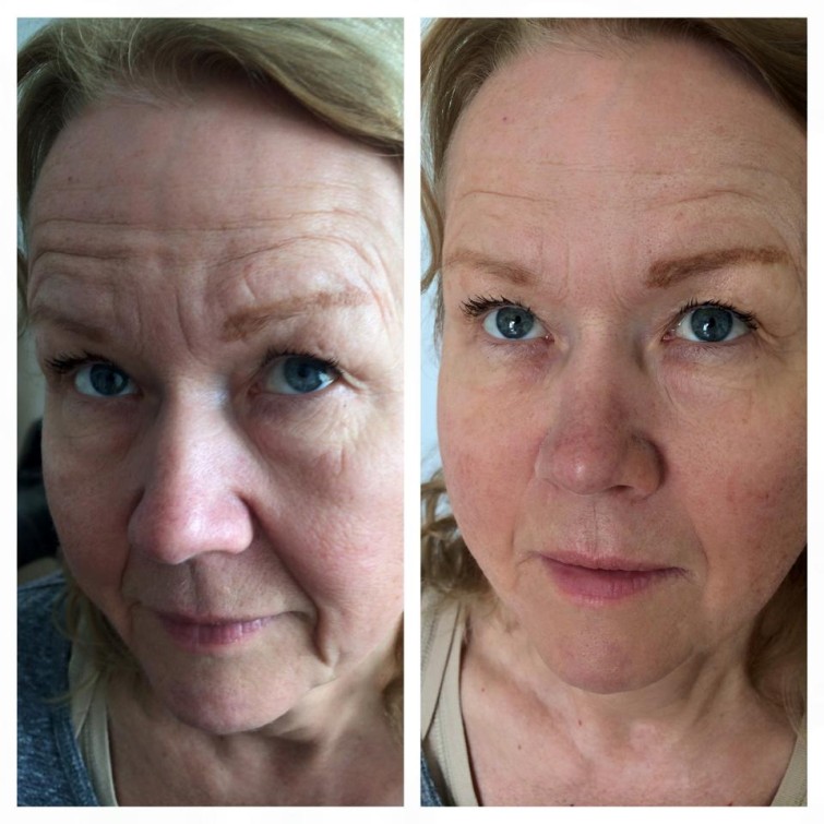 11037773_10153283098250993_7861207429281383278_n