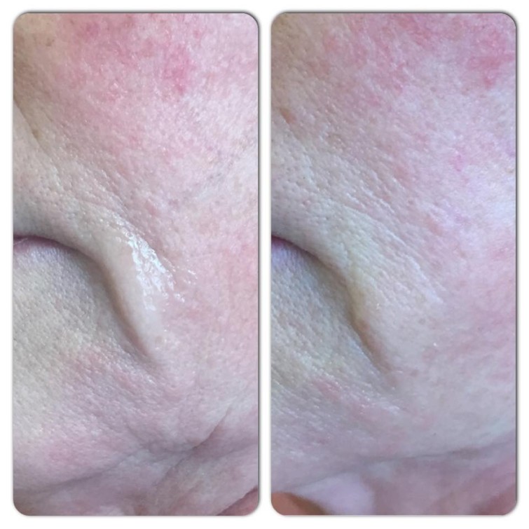 11261471_10152806280794147_1215854408_n