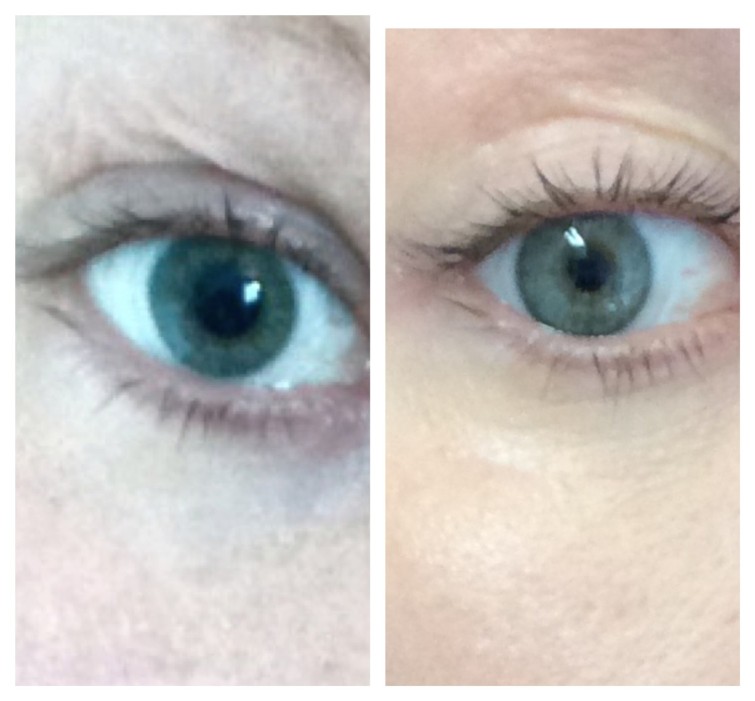 Processed with Moldiv