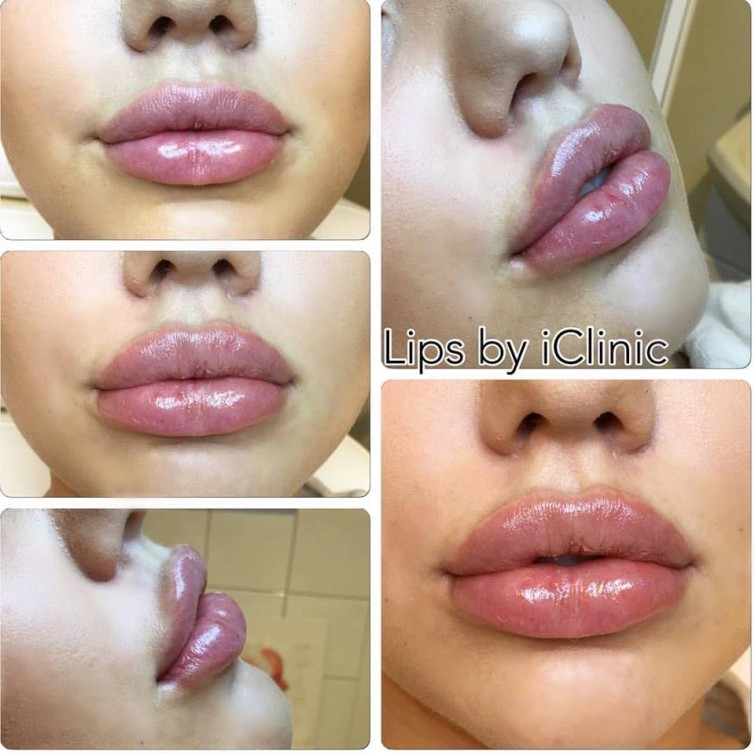 12985606_10209180551251715_3779412105748239683_n