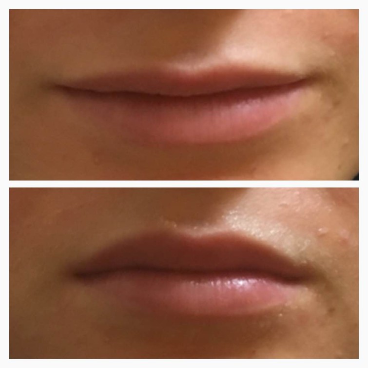 14192759_10153734746901576_5265391627837157932_n