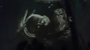 10444379_765562390133307_3770016669935716858_n