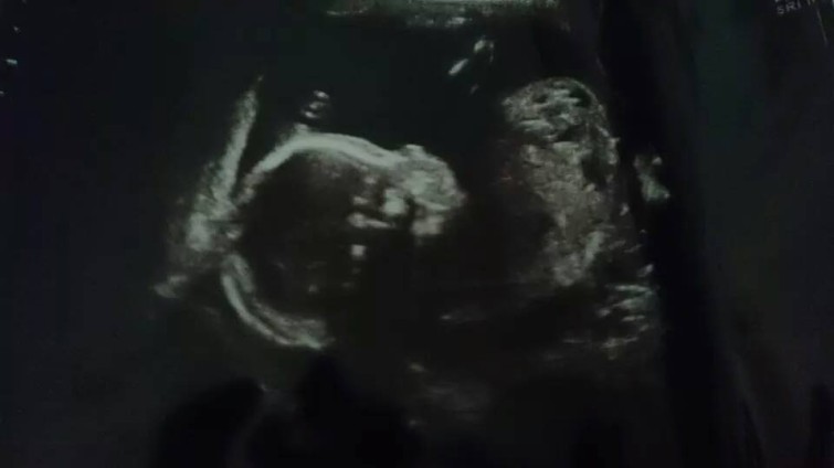 10502256_765562716799941_4738082301702935546_n