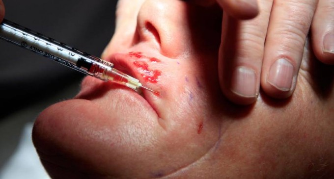 Att dessutom utföra behandlingen med smutsiga naglar och inga skyddshandskar är inte fördelaktigt. 